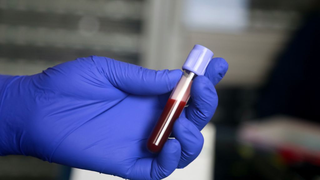 test de sangre HRA test de sangre HRA