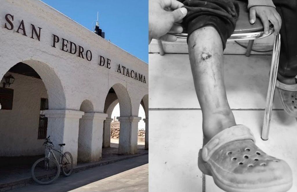 Municipalidad - Lesiones Menor de Edad Municipalidad - Lesiones Menor de Edad