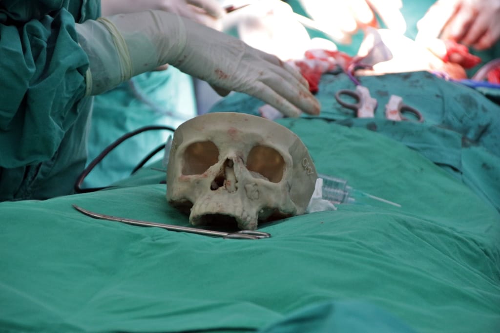 Cirugía Tumor Ameloblastoma Cirugía Tumor Ameloblastoma