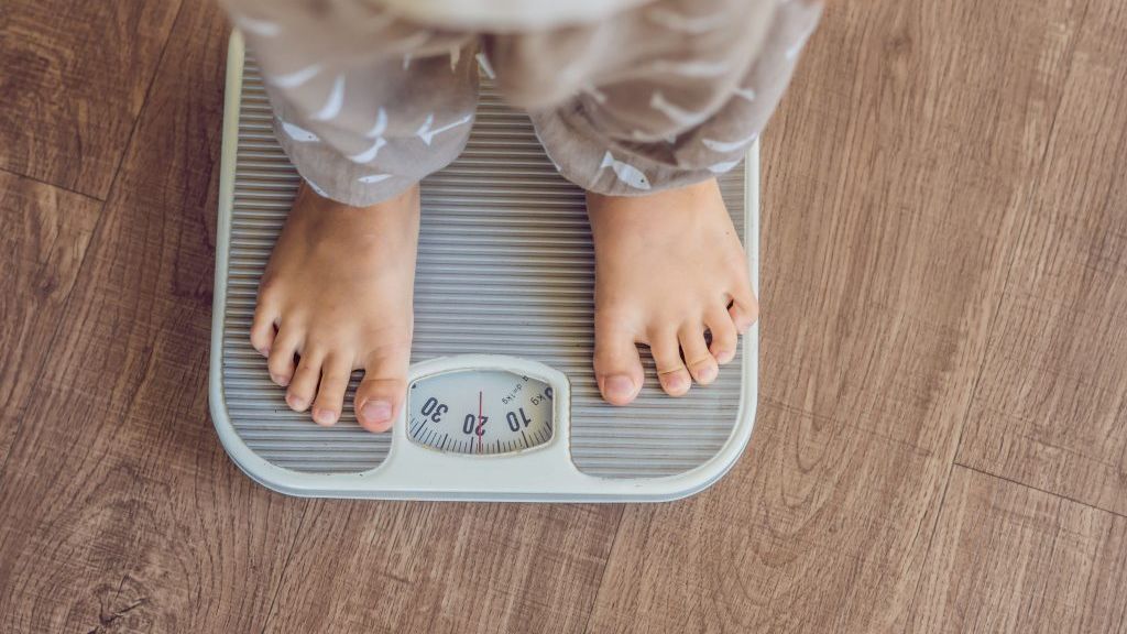 Obesidad infantil (contexto) Obesidad infantil (contexto)