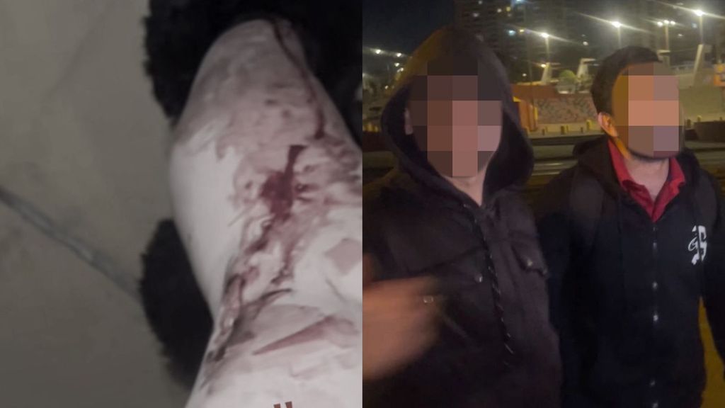 Ataque transfóbico Playa Trocadero Antofagasta