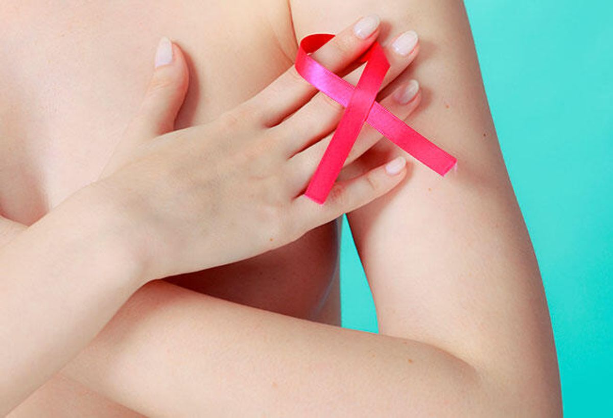 Cáncer de Mama