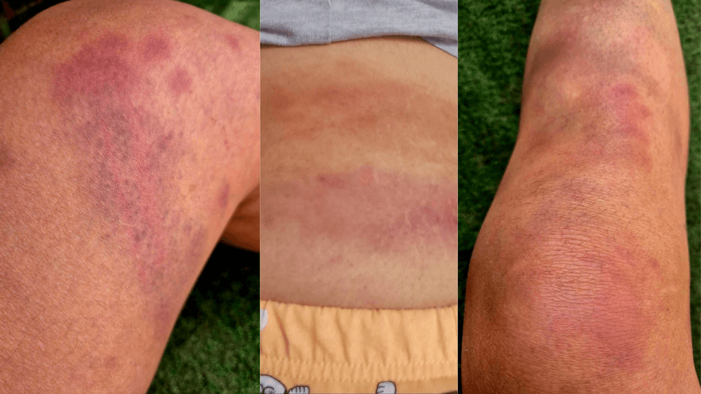 Golpiza Ripley Golpiza Ripley