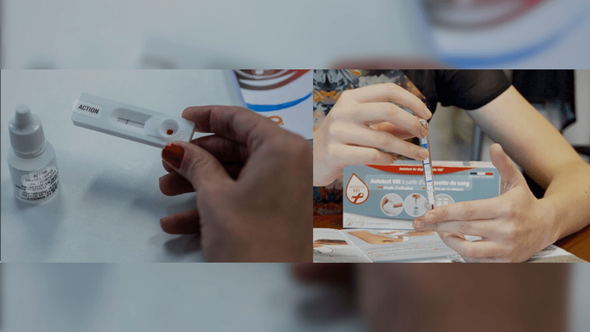 Antofagasta registra 262 nuevos casos de VIH en 2023 Antofagasta registra 262 nuevos casos de VIH en 2023