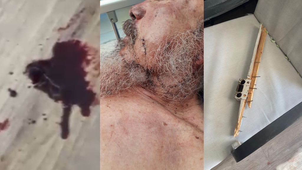 Ataque cabaña Juan Lopez