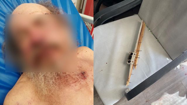 Ataque cabaña Juan Lopez