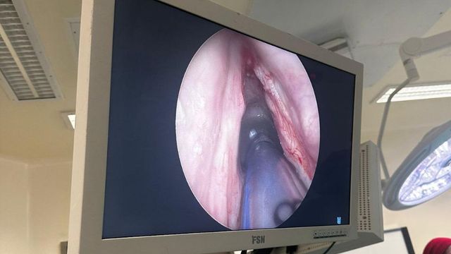 Cirugía de voz Cirugía de voz