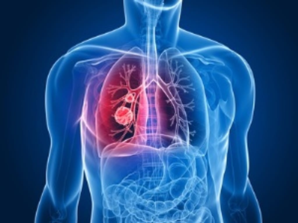 img-fibrosis-quistica img-fibrosis-quistica