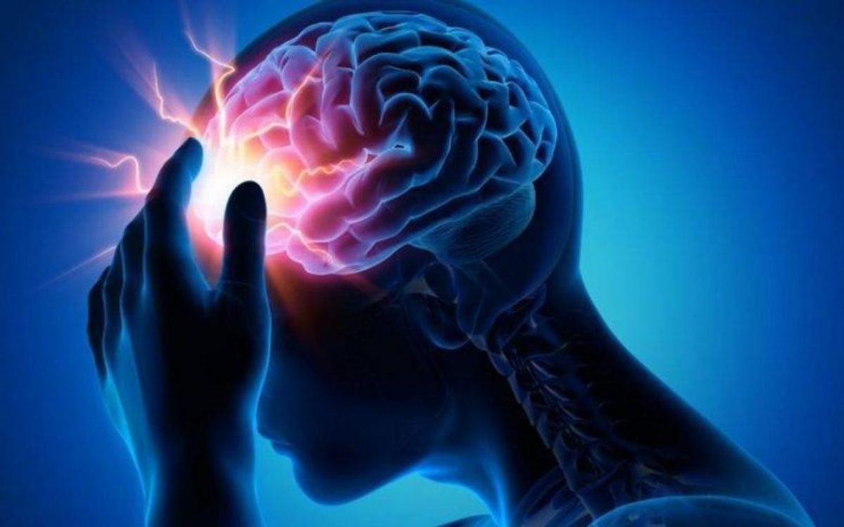 Infarto cerebral, ¿puede evitarse? Infarto cerebral, ¿puede evitarse?