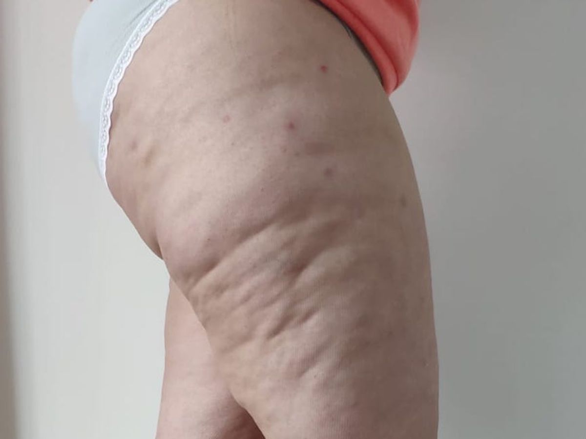 Cuidado con esta enfermedad Cuidado con esta enfermedad