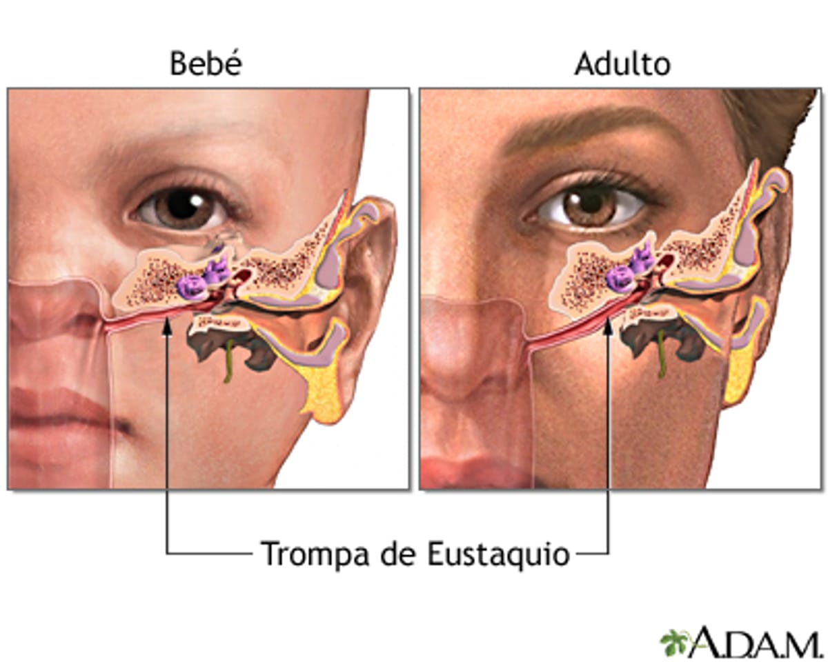 Cambios de temperaturas pueden producir otitis Cambios de temperaturas pueden producir otitis