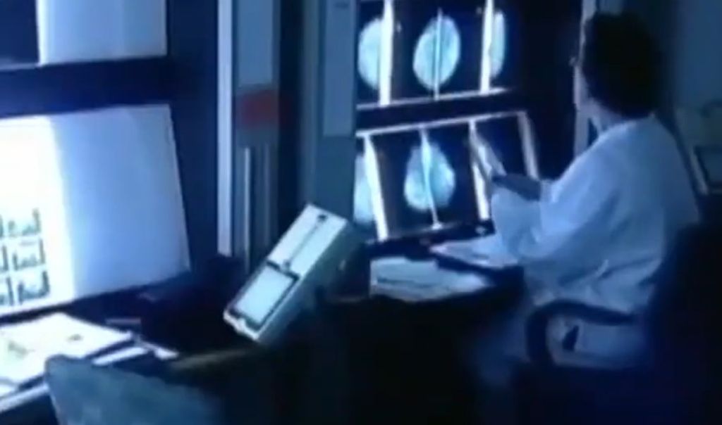 cancer cervicouterino cancer cervicouterino