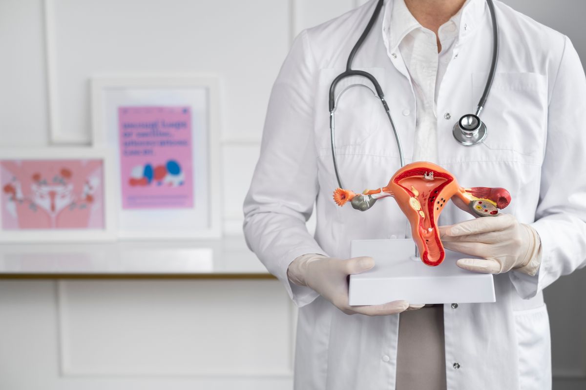 Cáncer de Ovario Cáncer de Ovario