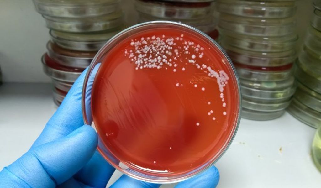 bacteria_asesina bacteria_asesina