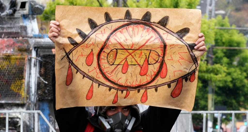 traumas-oculares-concepcion-750&#215;400