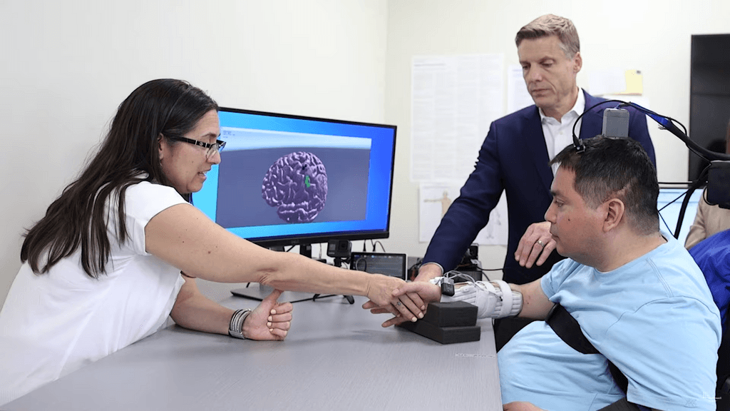 Microchips cerebrales con IA Microchips cerebrales con IA