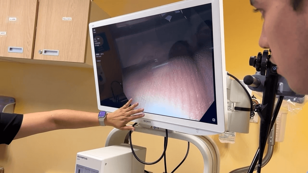 ENDOSCOPIA ENDOSCOPIA