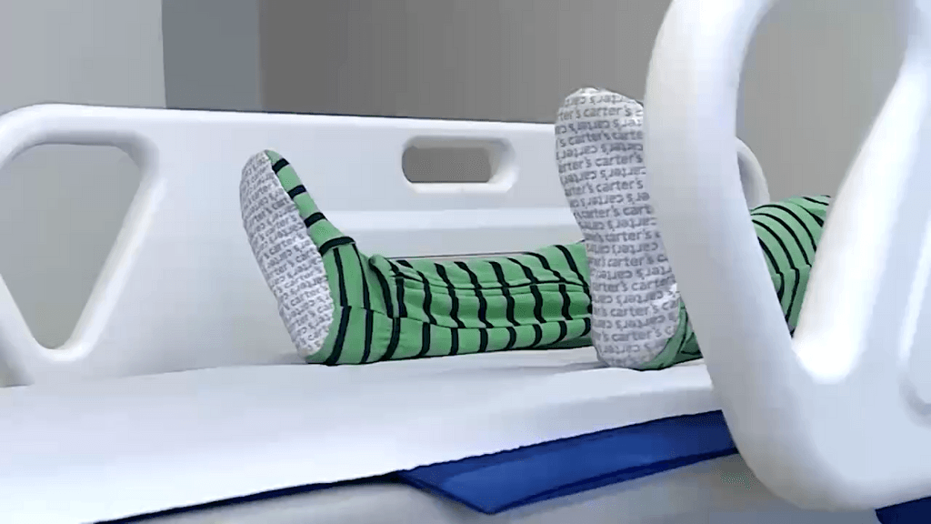 hospitalizaciones menores hospitalizaciones menores