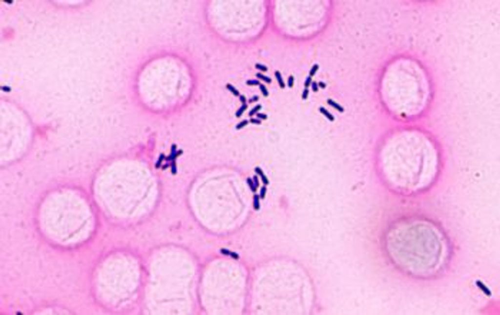 Listeria Listeria