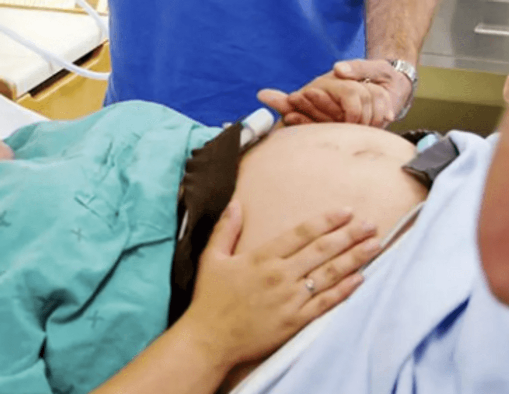 Parto embarazo Parto embarazo