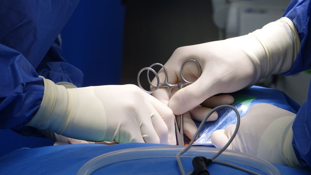 Abdominoplastia ICSA