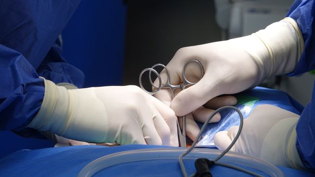 Abdominoplastia ICSA Abdominoplastia ICSA