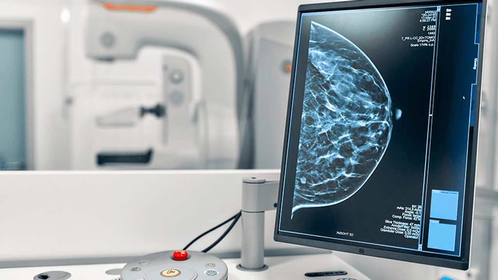 mamografia mamografia