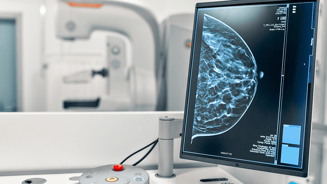 mamografia mamografia